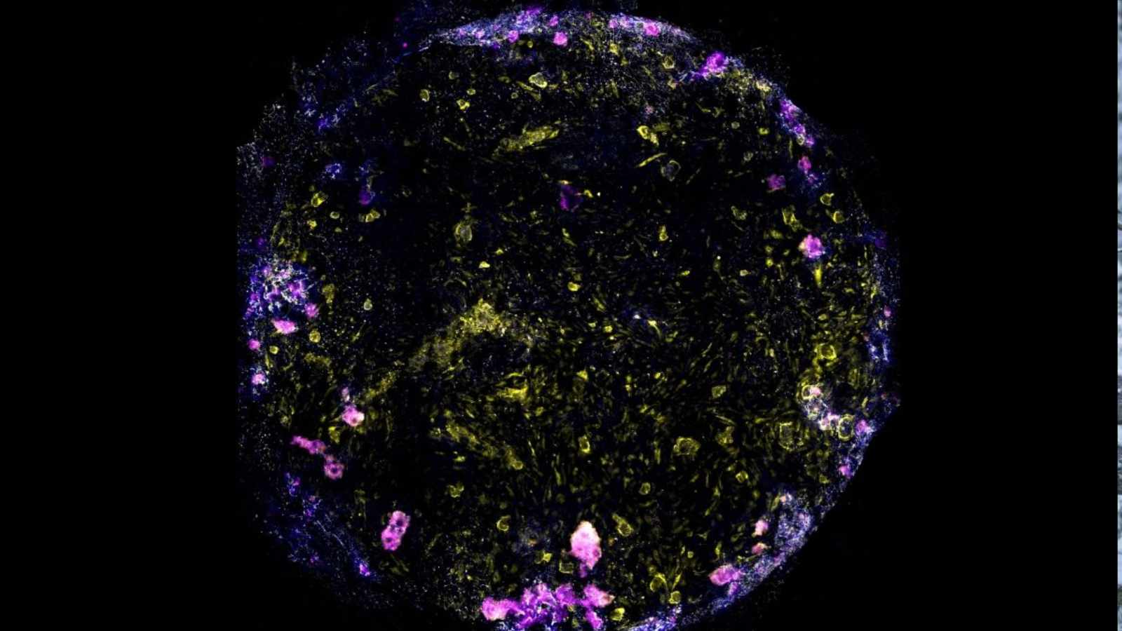 Vědci stvořili „plíce na čipu“. Nejsou z křemíku, ale z lidských buněk a odhalují tajemství tuberkulózy