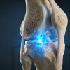 Konec umělých kloubů na obzoru? Revoluční injekce opravila zničenou chrupavku za pár týdnů