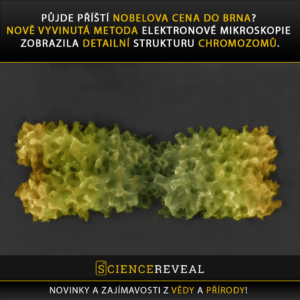 Půjde příští Nobelova cena do Brna? Nově vyvinutá metoda elektronové mikroskopie zobrazila detailní strukturu chromozomů.